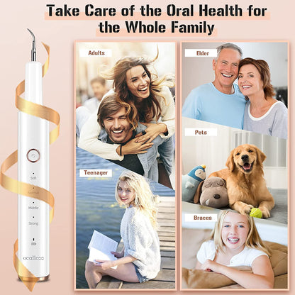 Ocallcoo electric plaque remover for teeth
Ocallcoo tartar remover with LED light
Ocallcoo ultrasonic tooth cleaner
Ocallcoo rechargeable teeth cleaning kit
Ocallcoo dental plaque and tartar remover
Ocallcoo electric tooth cleaning device
Ocallcoo teeth whitening and cleaning tool
Ocallcoo plaque remover with replaceable heads
Ocallcoo professional tooth cleaner
Ocallcoo LED dental cleaning tool